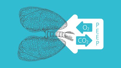 Illustration lung-protective ventilation